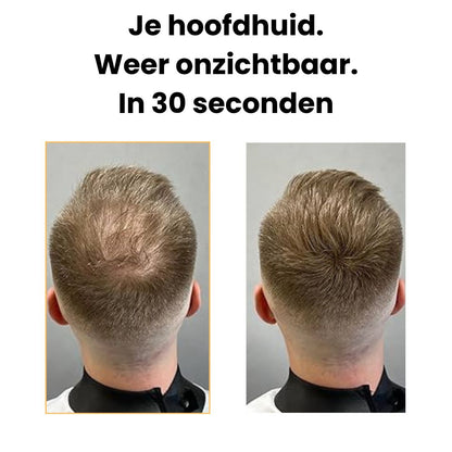 Haardichtheidsvuller