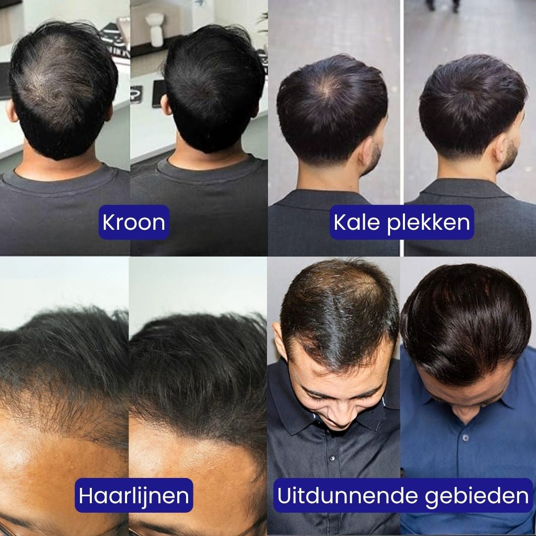 Haardichtheidsvuller